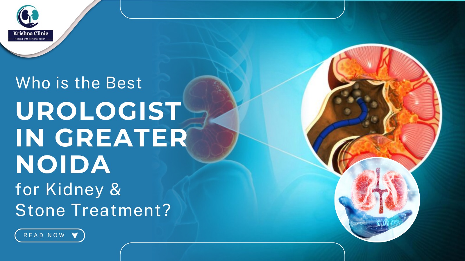 Best Urologist in Greater Noida