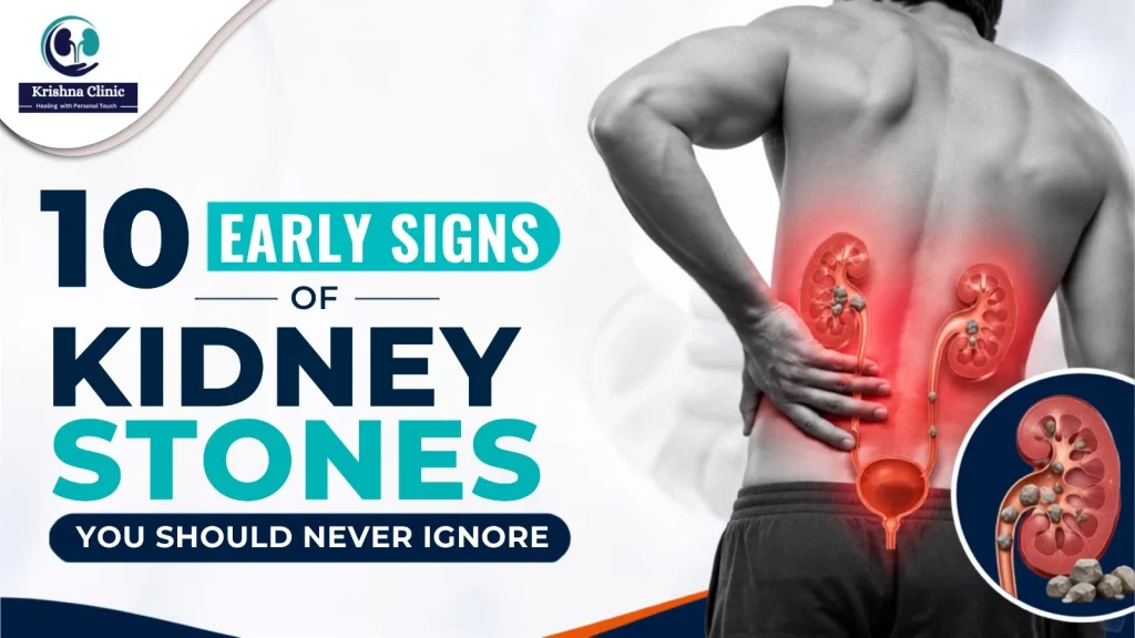 10 Early Signs of Kidney Stones You Should Never Ignore